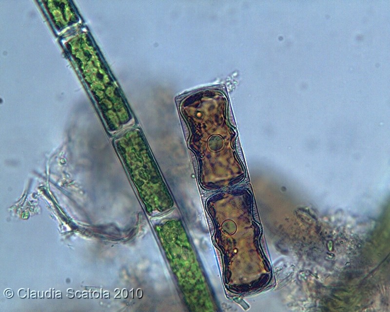 Alghe [ Melosira undulata ]
